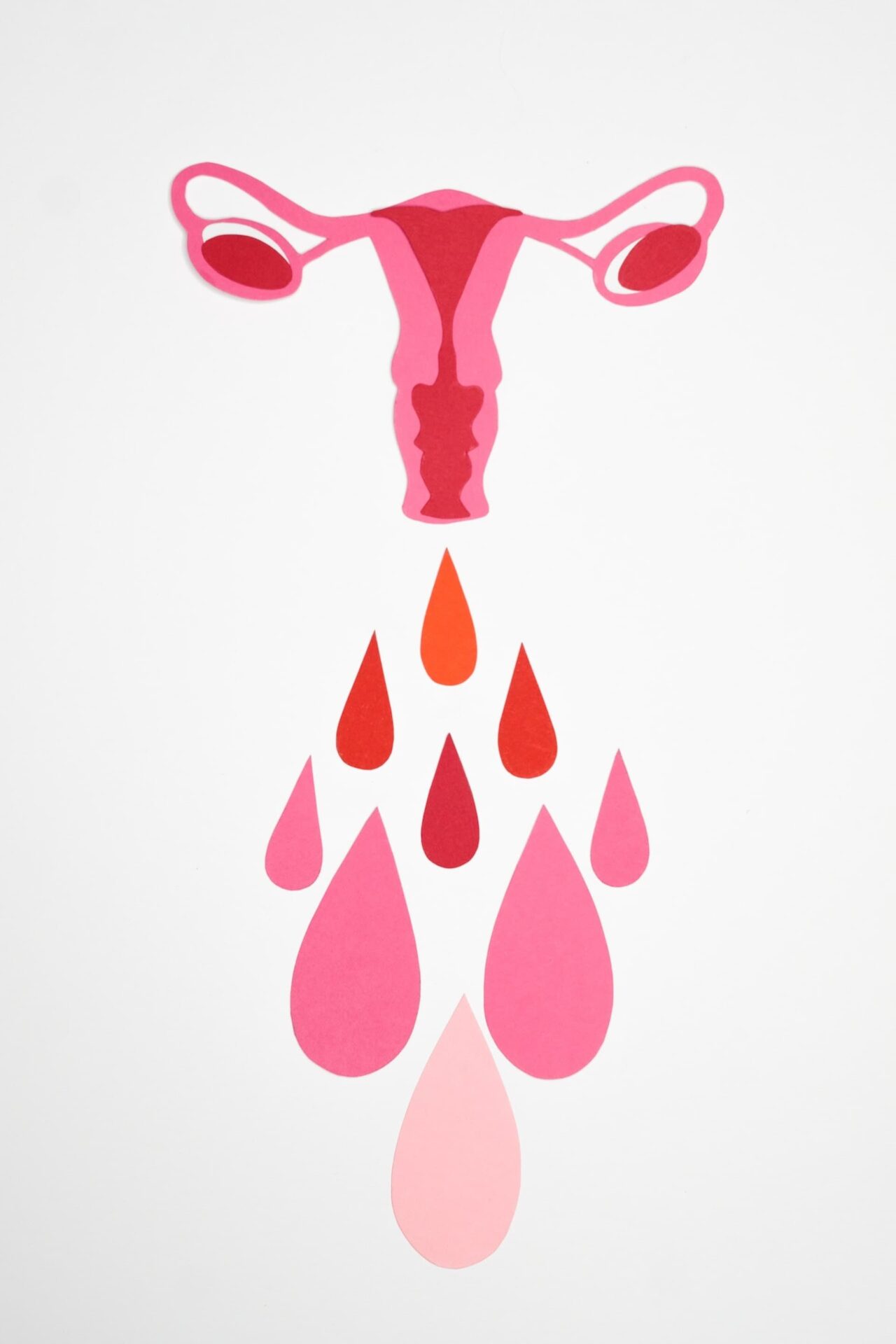 endometriosis despues de la menopausia